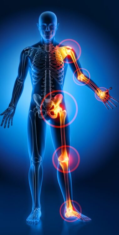 TMS TMS Troubles musculo-squelettiques